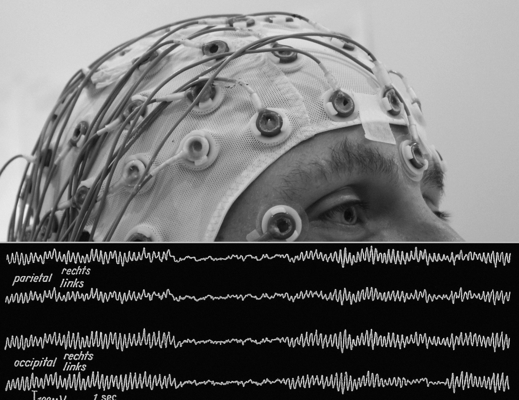 A person in an EEG electrode cap, with a real EEG trace of their brain rhythm below.